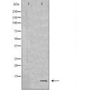 DF7427 at 1/100 staining Human Melanoma tissue by IHC-P. The sample was formaldehyde fixed and a heat mediated antigen retrieval step in citrate buffer was performed. The sample was then blocked and incubated with the antibody for 1.5 hours at 22¡ãC. An HRP conjugated goat anti-rabbit antibody was used as the secondary