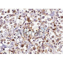 Western blot analysis of extracts from B16F10, using CTNNA1 Antibody. The lane on the left was treated with blocking peptide.