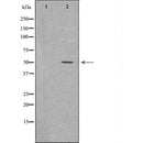 DF7434 at 1/100 staining Mouse liver tissue by IHC-P. The sample was formaldehyde fixed and a heat mediated antigen retrieval step in citrate buffer was performed. The sample was then blocked and incubated with the antibody for 1.5 hours at 22¡ãC. An HRP conjugated goat anti-rabbit antibody was used as the secondary