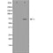 DF7435 at 1/100 staining Rat lung tissue by IHC-P. The sample was formaldehyde fixed and a heat mediated antigen retrieval step in citrate buffer was performed. The sample was then blocked and incubated with the antibody for 1.5 hours at 22¡ãC. An HRP conjugated goat anti-rabbit antibody was used as the secondary