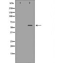 DF7436 at 1/100 staining Human gastric tissue by IHC-P. The sample was formaldehyde fixed and a heat mediated antigen retrieval step in citrate buffer was performed. The sample was then blocked and incubated with the antibody for 1.5 hours at 22¡ãC. An HRP conjugated goat anti-rabbit antibody was used as the secondary