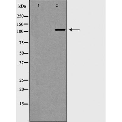 DF7438 at 1/100 staining Human gastric tissue by IHC-P. The sample was formaldehyde fixed and a heat mediated antigen retrieval step in citrate buffer was performed. The sample was then blocked and incubated with the antibody for 1.5 hours at 22¡ãC. An HRP conjugated goat anti-rabbit antibody was used as the secondary