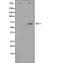 DF7440 staining HepG2 by IF/ICC. The sample were fixed with PFA and permeabilized in 0.1% Triton X-100,then blocked in 10% serum for 45 minutes at 25¡ãC. The primary antibody was diluted at 1/200 and incubated with the sample for 1 hour at 37¡ãC. An  Alexa Fluor 594 conjugated goat anti-rabbit IgG (H+L) Ab, diluted at 1/600, was used as the secondary antibod