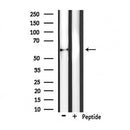 DF7441 at 1/100 staining Human melanoma tissue by IHC-P. The sample was formaldehyde fixed and a heat mediated antigen retrieval step in citrate buffer was performed. The sample was then blocked and incubated with the antibody for 1.5 hours at 22¡ãC. An HRP conjugated goat anti-rabbit antibody was used as the secondary