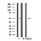 DF7442 at 1/100 staining Mouse muscle tissue by IHC-P. The sample was formaldehyde fixed and a heat mediated antigen retrieval step in citrate buffer was performed. The sample was then blocked and incubated with the antibody for 1.5 hours at 22¡ãC. An HRP conjugated goat anti-rabbit antibody was used as the secondary