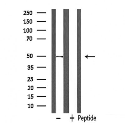 DF7442 at 1/100 staining Mouse muscle tissue by IHC-P. The sample was formaldehyde fixed and a heat mediated antigen retrieval step in citrate buffer was performed. The sample was then blocked and incubated with the antibody for 1.5 hours at 22¡ãC. An HRP conjugated goat anti-rabbit antibody was used as the secondary