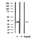 DF7449 at 1/100 staining Human gastric tissue by IHC-P. The sample was formaldehyde fixed and a heat mediated antigen retrieval step in citrate buffer was performed. The sample was then blocked and incubated with the antibody for 1.5 hours at 22¡ãC. An HRP conjugated goat anti-rabbit antibody was used as the secondary