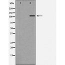 DF7452 at 1/100 staining Mouse spleen tissue by IHC-P. The sample was formaldehyde fixed and a heat mediated antigen retrieval step in citrate buffer was performed. The sample was then blocked and incubated with the antibody for 1.5 hours at 22¡ãC. An HRP conjugated goat anti-rabbit antibody was used as the secondary