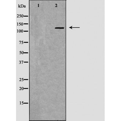 DF7457 staining Hela by IF/ICC. The sample were fixed with PFA and permeabilized in 0.1% Triton X-100,then blocked in 10% serum for 45 minutes at 25¡ãC. The primary antibody was diluted at 1/200 and incubated with the sample for 1 hour at 37¡ãC. An  Alexa Fluor 594 conjugated goat anti-rabbit IgG (H+L) Ab, diluted at 1/600, was used as the secondary antibod