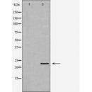 DF7462 at 1/100 staining Human liver tissue by IHC-P. The sample was formaldehyde fixed and a heat mediated antigen retrieval step in citrate buffer was performed. The sample was then blocked and incubated with the antibody for 1.5 hours at 22¡ãC. An HRP conjugated goat anti-rabbit antibody was used as the secondary