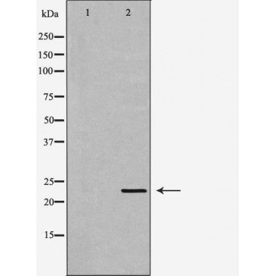 DF7462 at 1/100 staining Human liver tissue by IHC-P. The sample was formaldehyde fixed and a heat mediated antigen retrieval step in citrate buffer was performed. The sample was then blocked and incubated with the antibody for 1.5 hours at 22¡ãC. An HRP conjugated goat anti-rabbit antibody was used as the secondary