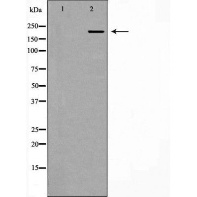 DF7464 at 1/100 staining Human lymph tissue by IHC-P. The sample was formaldehyde fixed and a heat mediated antigen retrieval step in citrate buffer was performed. The sample was then blocked and incubated with the antibody for 1.5 hours at 22¡ãC. An HRP conjugated goat anti-rabbit antibody was used as the secondary