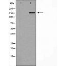 DF7466 at 1/100 staining Human lung tissue by IHC-P. The sample was formaldehyde fixed and a heat mediated antigen retrieval step in citrate buffer was performed. The sample was then blocked and incubated with the antibody for 1.5 hours at 22¡ãC. An HRP conjugated goat anti-rabbit antibody was used as the secondary
