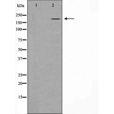 DF7472 staining Hela by IF/ICC. The sample were fixed with PFA and permeabilized in 0.1% Triton X-100,then blocked in 10% serum for 45 minutes at 25¡ãC. The primary antibody was diluted at 1/200 and incubated with the sample for 1 hour at 37¡ãC. An  Alexa Fluor 594 conjugated goat anti-rabbit IgG (H+L) Ab, diluted at 1/600, was used as the secondary antibod