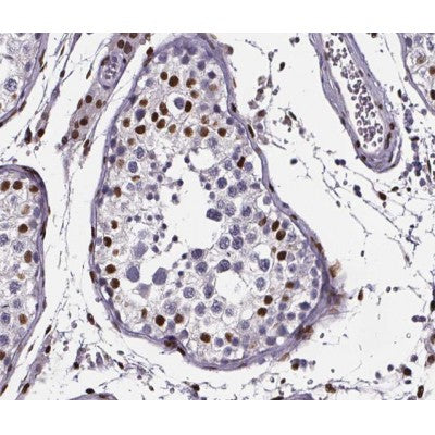 AF0139 at 1/200 staining human testis tissue sections by IHC-P. The tissue was formaldehyde fixed and a heat mediated antigen retrieval step in citrate buffer was performed. The tissue was then blocked and incubated with the antibody for 1.5 hours at 22¡ãC. An HRP conjugated goat anti-rabbit antibody was used as the secondary