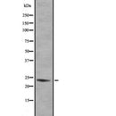 DF2201 at 1/100 staining Mouse lung tissue by IHC-P. The sample was formaldehyde fixed and a heat mediated antigen retrieval step in citrate buffer was performed. The sample was then blocked and incubated with the antibody for 1.5 hours at 22¡ãC. An HRP conjugated goat anti-rabbit antibody was used as the secondary