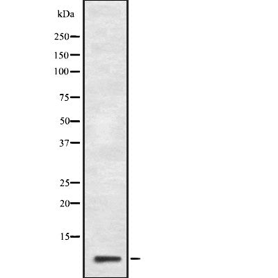 Western blot analysis of GNG10 expression in HepG2 cell lysate,The lane on the left is treated with the antigen-specific peptide.