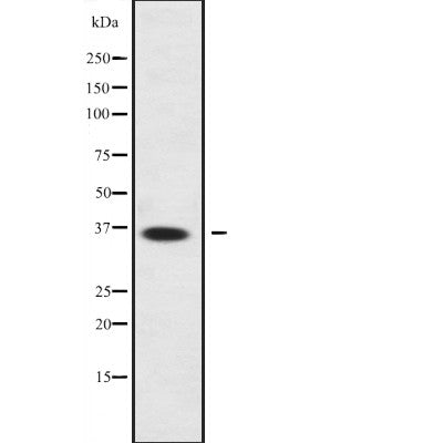 DF2208 at 1/100 staining Human Melanoma tissue by IHC-P. The sample was formaldehyde fixed and a heat mediated antigen retrieval step in citrate buffer was performed. The sample was then blocked and incubated with the antibody for 1.5 hours at 22¡ãC. An HRP conjugated goat anti-rabbit antibody was used as the secondary