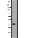 Western blot analysis of SLC25A27 expression in 293T cell lysate,The lane on the left is treated with the antigen-specific peptide.