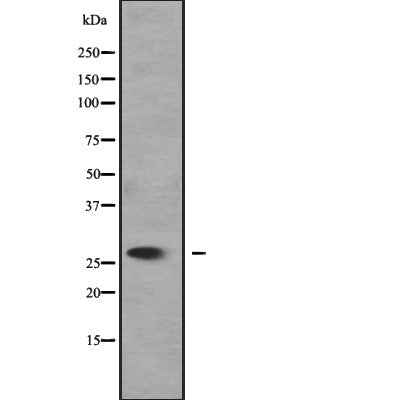 Western blot analysis of SLC25A27 expression in 293T cell lysate,The lane on the left is treated with the antigen-specific peptide.