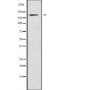 Western blot analysis of MYO1F expression in  A673 lysate,The lane on the left is treated with the antigen-specific peptide.