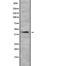 DF2211 at 1/100 staining Human gastric tissue by IHC-P. The sample was formaldehyde fixed and a heat mediated antigen retrieval step in citrate buffer was performed. The sample was then blocked and incubated with the antibody for 1.5 hours at 22¡ãC. An HRP conjugated goat anti-rabbit antibody was used as the secondary