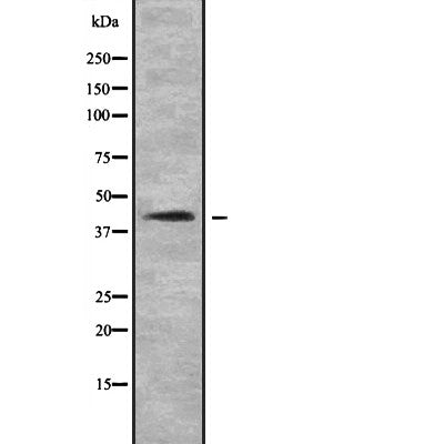 DF2211 at 1/100 staining Human gastric tissue by IHC-P. The sample was formaldehyde fixed and a heat mediated antigen retrieval step in citrate buffer was performed. The sample was then blocked and incubated with the antibody for 1.5 hours at 22¡ãC. An HRP conjugated goat anti-rabbit antibody was used as the secondary