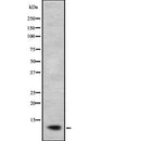 Western blot analysis of NDUFB2 expression in  A673 lysate;,The lane on the left is treated with the antigen-specific peptide.