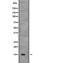 Western blot analysis of NDUFB6 expression in Mouse kidney tissue lysate;,The lane on the left is treated with the antigen-specific peptide.