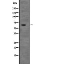 Western blot analysis of UNC5C expression in 293T whole cell lysate ,The lane on the left is treated with the antigen-specific peptide.