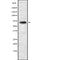 DF2215 at 1/100 staining Mouse kidney tissue by IHC-P. The sample was formaldehyde fixed and a heat mediated antigen retrieval step in citrate buffer was performed. The sample was then blocked and incubated with the antibody for 1.5 hours at 22¡ãC. An HRP conjugated goat anti-rabbit antibody was used as the secondary