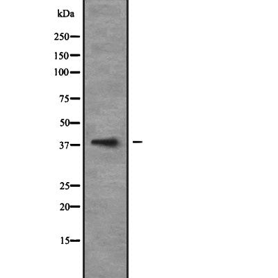 Western blot analysis of NEUROD6 expression in 293T whole cell lysate ,The lane on the left is treated with the antigen-specific peptide.