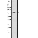 Western blot analysis of NFE2L1 expression in  Mouse testis lysate,The lane on the left is treated with the antigen-specific peptide.