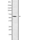 DF2218 at 1/100 staining Rat heart tissue by IHC-P. The sample was formaldehyde fixed and a heat mediated antigen retrieval step in citrate buffer was performed. The sample was then blocked and incubated with the antibody for 1.5 hours at 22¡ãC. An HRP conjugated goat anti-rabbit antibody was used as the secondary