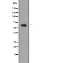 Western blot analysis of NR2C2 expression in  293T cell lysate,The lane on the left is treated with the antigen-specific peptide.