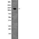 Western blot analysis of PEX1 expression in Mouse liver lysate,The lane on the left is treated with the antigen-specific peptide.