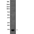 Western blot analysis of KCNE2 expression in Pancreas (Mouse) Tissue Lysate ,The lane on the left is treated with the antigen-specific peptide.
