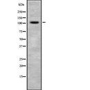 DF2223 at 1/100 staining Human prostate tissue by IHC-P. The sample was formaldehyde fixed and a heat mediated antigen retrieval step in citrate buffer was performed. The sample was then blocked and incubated with the antibody for 1.5 hours at 22¡ãC. An HRP conjugated goat anti-rabbit antibody was used as the secondary