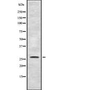 Western blot analysis of SYF2 expression in Mouse liver lysate,The lane on the left is treated with the antigen-specific peptide.