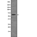 DF2227 at 1/100 staining Human gastric tissue by IHC-P. The sample was formaldehyde fixed and a heat mediated antigen retrieval step in citrate buffer was performed. The sample was then blocked and incubated with the antibody for 1.5 hours at 22¡ãC. An HRP conjugated goat anti-rabbit antibody was used as the secondary