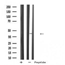 DF2228 at 1/100 staining RAT testis tissue by IHC-P. The sample was formaldehyde fixed and a heat mediated antigen retrieval step in citrate buffer was performed. The sample was then blocked and incubated with the antibody for 1.5 hours at 22¡ãC. An HRP conjugated goat anti-rabbit antibody was used as the secondary