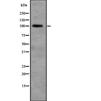 Western blot analysis of RALGDS expression in  Liver (Human) Tissue Lysate ,The lane on the left is treated with the antigen-specific peptide.