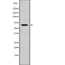 DF2234 at 1/100 staining Human liver tissue by IHC-P. The sample was formaldehyde fixed and a heat mediated antigen retrieval step in citrate buffer was performed. The sample was then blocked and incubated with the antibody for 1.5 hours at 22¡ãC. An HRP conjugated goat anti-rabbit antibody was used as the secondary