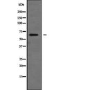 DF2236 at 1/100 staining Human lung tissue by IHC-P. The sample was formaldehyde fixed and a heat mediated antigen retrieval step in citrate buffer was performed. The sample was then blocked and incubated with the antibody for 1.5 hours at 22¡ãC. An HRP conjugated goat anti-rabbit antibody was used as the secondary