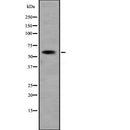 Western blot analysis of extracts from K562, using KCNN1 Antibody. The lane on the left was treated with blocking peptide.