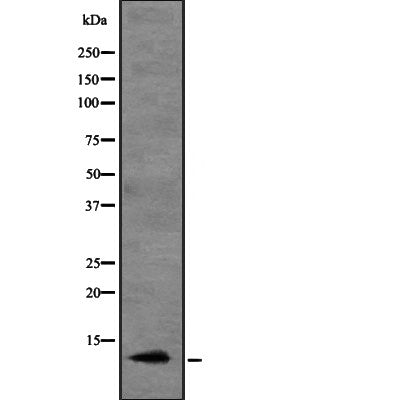 DF2238 at 1/100 staining Mouse testis tissue by IHC-P. The sample was formaldehyde fixed and a heat mediated antigen retrieval step in citrate buffer was performed. The sample was then blocked and incubated with the antibody for 1.5 hours at 22¡ãC. An HRP conjugated goat anti-rabbit antibody was used as the secondary