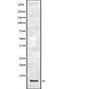 DF2239 at 1/100 staining Human pancreas tissue by IHC-P. The sample was formaldehyde fixed and a heat mediated antigen retrieval step in citrate buffer was performed. The sample was then blocked and incubated with the antibody for 1.5 hours at 22¡ãC. An HRP conjugated goat anti-rabbit antibody was used as the secondary