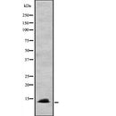 DF2240 at 1/100 staining Human lymph node tissue by IHC-P. The sample was formaldehyde fixed and a heat mediated antigen retrieval step in citrate buffer was performed. The sample was then blocked and incubated with the antibody for 1.5 hours at 22¡ãC. An HRP conjugated goat anti-rabbit antibody was used as the secondary