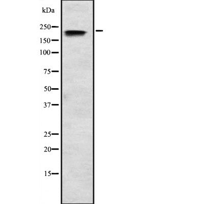 DF2241 at 1/100 staining Human liver cancer tissue by IHC-P. The sample was formaldehyde fixed and a heat mediated antigen retrieval step in citrate buffer was performed. The sample was then blocked and incubated with the antibody for 1.5 hours at 22¡ãC. An HRP conjugated goat anti-rabbit antibody was used as the secondary