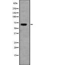 Western blot analysis of extracts from various samples, using SLC5A5 Antibody.
 Lane 1: Mouse  lung treated with blocking peptide;
 Lane 2: Mouse  lung;
 Lane 3: Hybridoma cells.